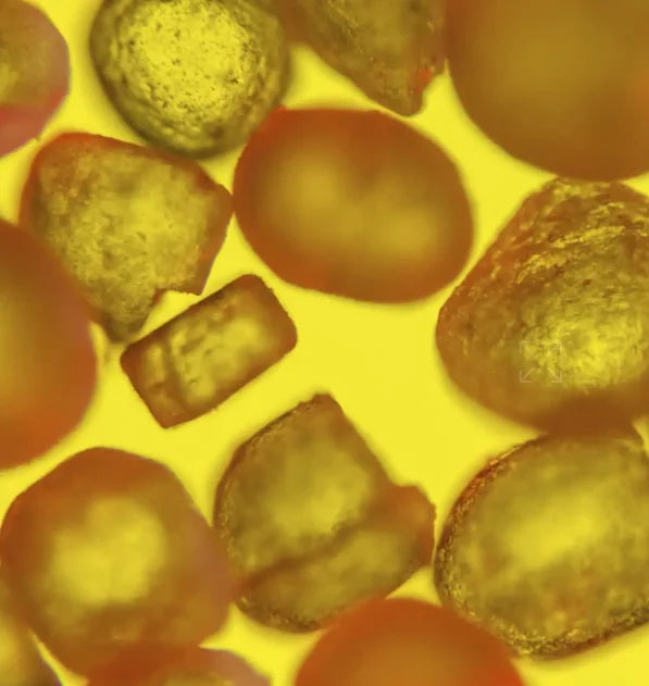 Vue rapprochée au microscope optique montrant diverses particules et formes organiques dans des tons ocre et brun sur un fond jaune vif.